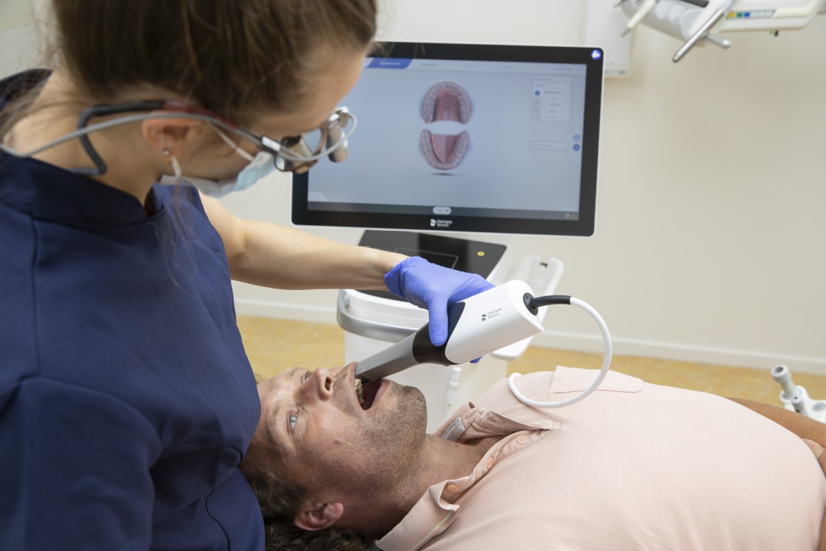 Digitaal scannen van kies voor CEREC kroon